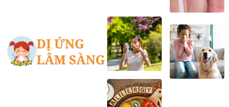 Dị ứng lâm sàng